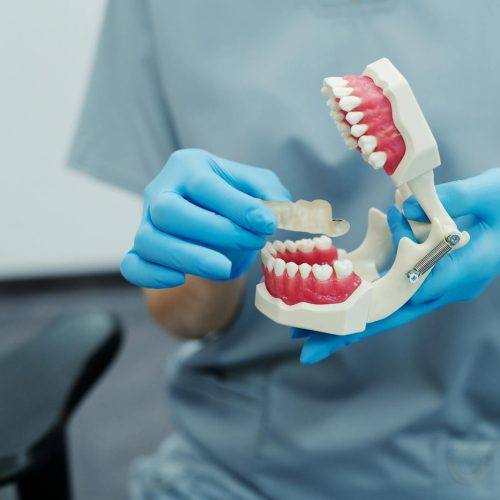 Close-up of a dental professional demonstrating with a teeth model in a clinic setting.